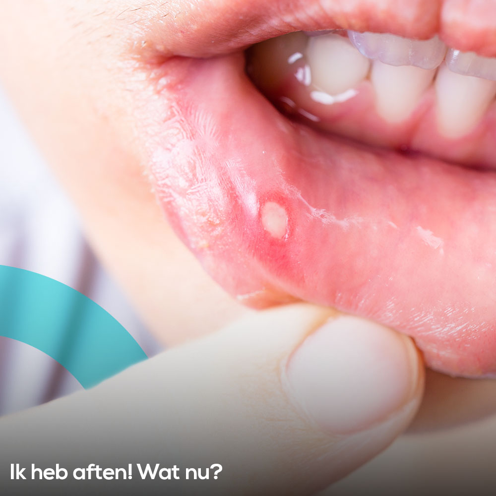 Alles wat je moet weten over aften